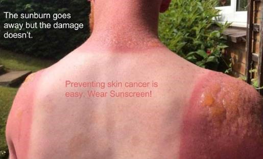 Congratulations To The Winners Of The 17 Sun Safety Meme Challenge Montana Cancer Coalition